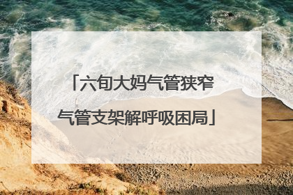 六旬大妈气管狭窄 气管支架解呼吸困局